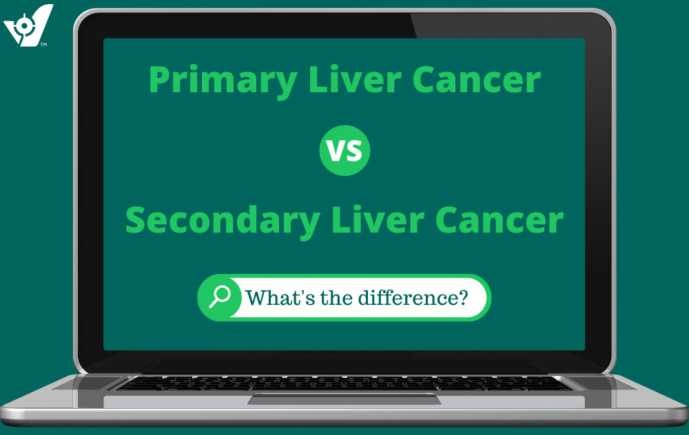 primary and secondary liver cancer treatment center NY